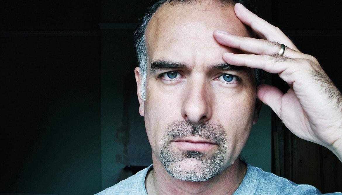 1. Risker och komplikationer vid hårtransplantation:‍ Viktiga överväganden och viktiga rekommendationer